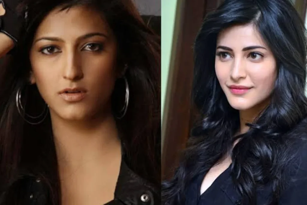 Shruti Haasan Has Undergone Plastic Surgery